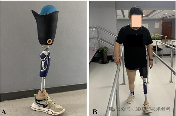 西交大:连续纤维增强复合材料康复辅具形性协同设计与3d打印