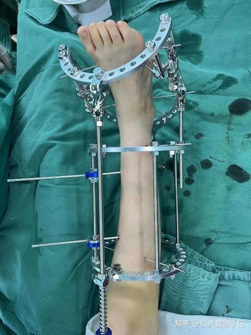 从手术到康复到辅具,一篇讲清申请路径