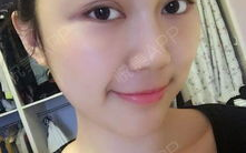 私密术后打几天消炎针,守护健康，助力恢复